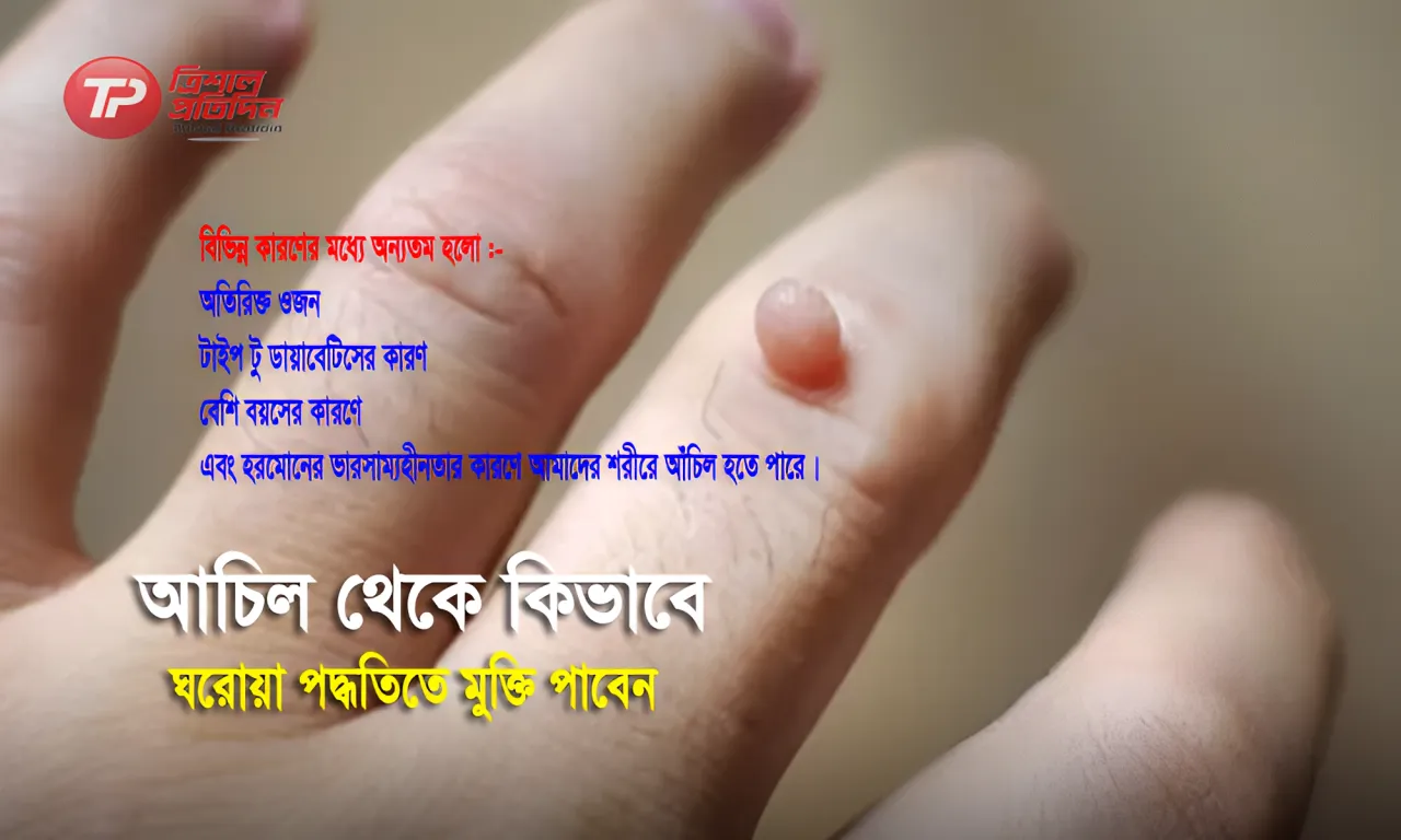 আচিল থেকে কিভাবে ঘরোয়া পদ্ধতি