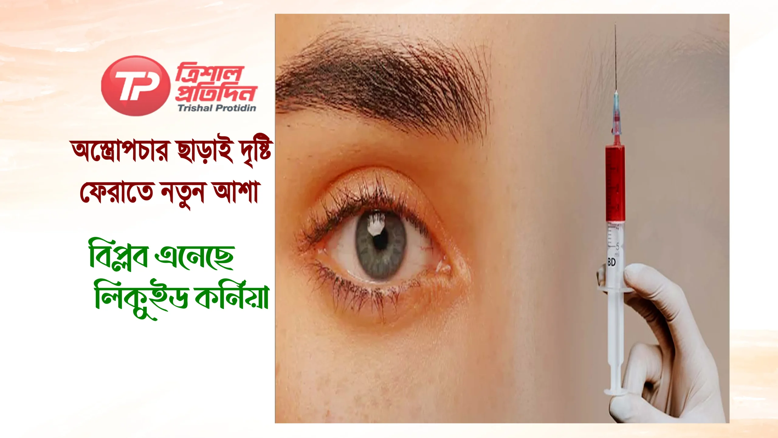 অস্ত্রোপচার ছাড়াই দৃষ্টি ফেরাতে নতুন আশা, বিপ্লব এনেছে ‘লিকুইড কর্নিয়া’