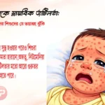 হামের পর শিশুদের যে ভয়াবহ ঝুঁকি