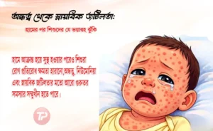 হামের পর শিশুদের যে ভয়াবহ ঝুঁকি