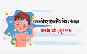ময়মনসিংহে হামের টিকা দিয়েও থামছেনা আক্রান্ত আর মৃত্যুর সংখ্যা