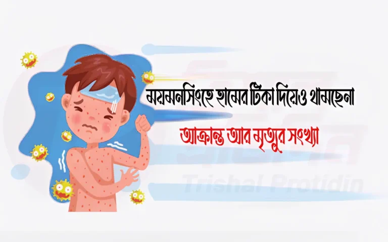 ময়মনসিংহে হামের টিকা দিয়েও থামছেনা আক্রান্ত আর মৃত্যুর সংখ্যা